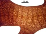 4 - Cellule corticali in visione superficiale